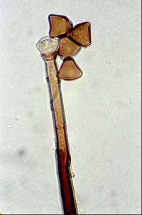 Chaetosphaeria novae-zelandiae image