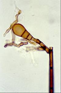 Chaetosphaeria novae-zelandiae image