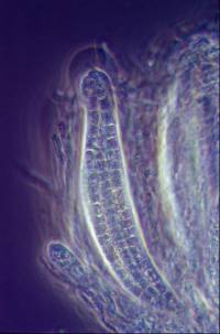 Acanthostigma scopulum image