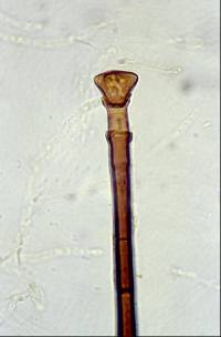 Chaetosphaeria novae-zelandiae image