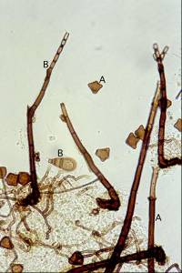 Chaetosphaeria novae-zelandiae image