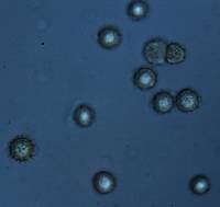 Pisolithus croceorrhizus image