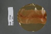 Cryptosporiopsis actinidiae image