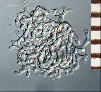 Pseudoclathrosphaerina spiralis image