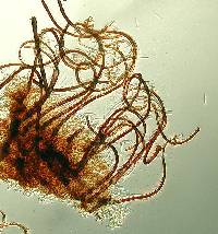 Circinotrichum maculiforme image