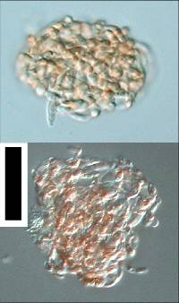 Spirosphaera floriformis image