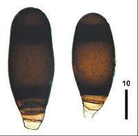 Bactrodesmium abruptum image