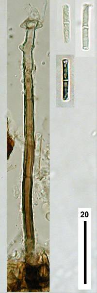 Anungitea heterospora image