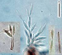 Subramaniomyces fusisaprophyticus image