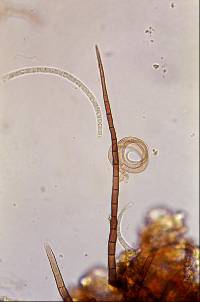 Thaxteriella helicoma image