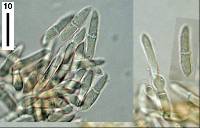 Plectosporium alismatis image