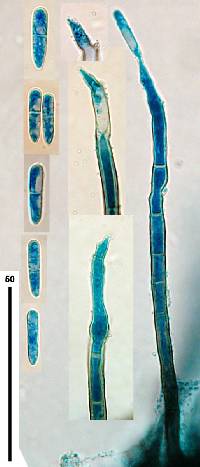 Image of Cylindrotrichum clavatum