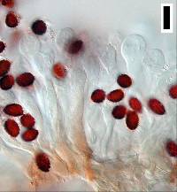 Lacrymaria asperospora image