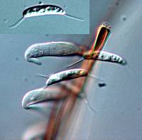 Menispora ciliata image