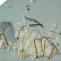 Circinotrichum maculiforme image