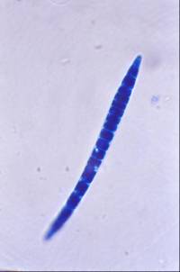 Thaxteriella helicoma image