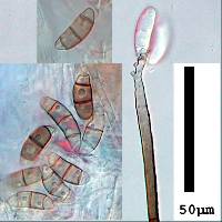 Pleurothecium recurvatum image