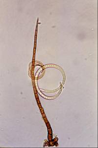 Thaxteriella helicoma image