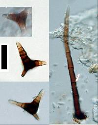 Image of Triposporium verruculosum