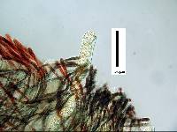 Scutellinia kerguelensis image