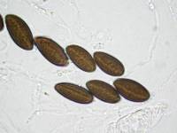 Daldinia dennisii var. microspora image