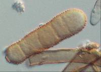 Cladosporium pseudiridis image