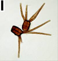 Tetraplosphaeria tetraploa image