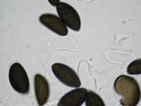 Daldinia dennisii var. microspora image