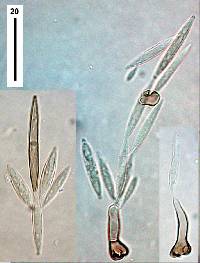 Subramaniomyces fusisaprophyticus image