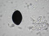 Daldinia novae-zelandiae image