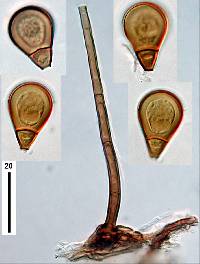 Endophragmiella boewei image