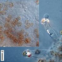 Astrosporina leptospermi image