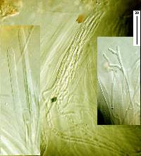 Stictis radiata image