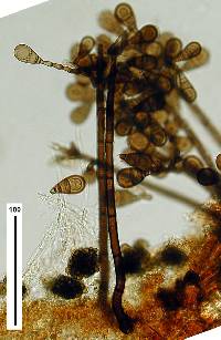 Brachysporiella pulchra image