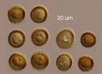 Ustilago avenae image