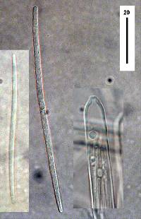 Lachnellula rhopalostylidis image