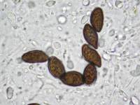 Daldinia dennisii var. microspora image