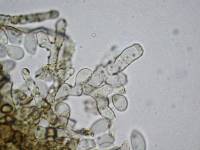 Daldinia dennisii var. microspora image