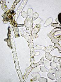 Daldinia dennisii var. microspora image