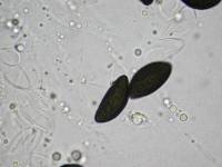 Daldinia dennisii var. microspora image