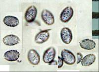 Melanoleuca exscissa var. exscissa image