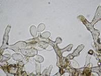 Daldinia dennisii var. microspora image