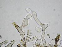 Daldinia dennisii var. microspora image