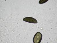 Daldinia dennisii var. microspora image