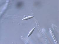 Micropodia filicea image