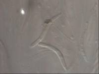 Hypoderma sigmoideum image