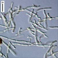 Dacrymyces stillatus image