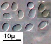 Hyphodontia radula image