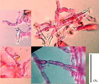 Golovinomyces biocellatus image