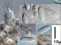 Echinochaete russiceps image